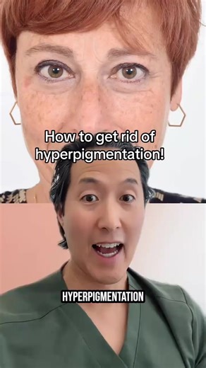 718K views · 4.6K reactions | Your action plan for age spots  #hyperpigmentation #melasma #skincaretips | Dr. Anthony Youn | Facebook
