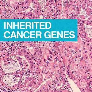 3.1K views · 80 reactions | A new study into a rare type of...