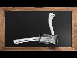 Elbow Dyplasia Diagnosis