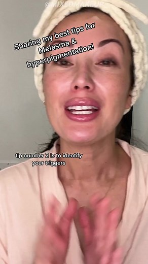 Melasma Tips for Healthy Skin Care