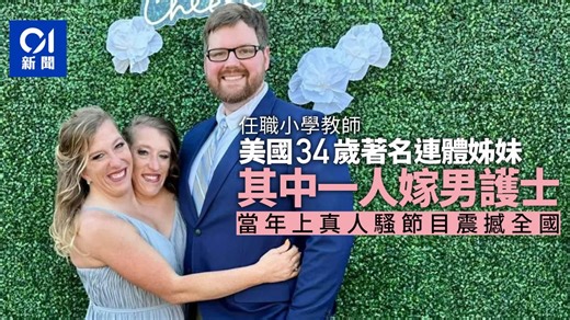 美國連體孖女之一Abby Hensel被爆結婚　丈夫是男護士
