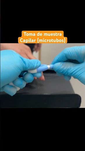 Capillary sample collection (2 microtubes) #phlebotomy #clinicalanalysis