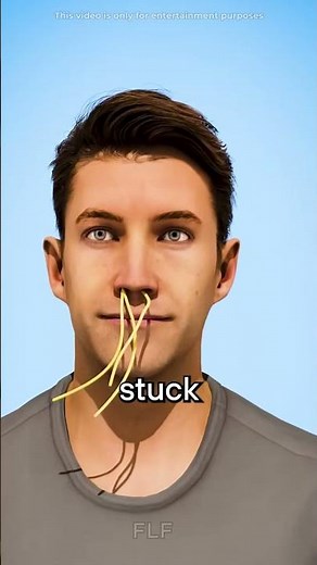 Objects Stuck Inside for Decades 😳