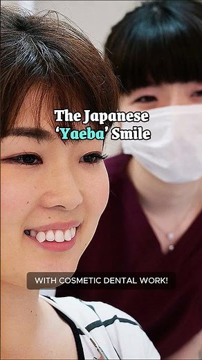 The Japanese ‘Yaeba’ Smile