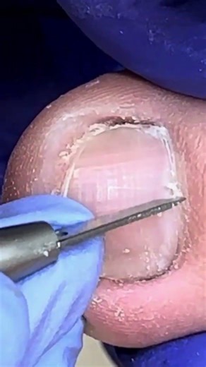 Easy Nail Cleaning at Home | Clean & Fresh Nails! #nails #cleaning