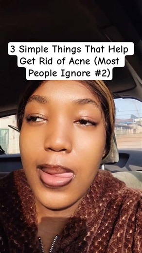 3 Simple Things That Help Get Rid of Acne.
