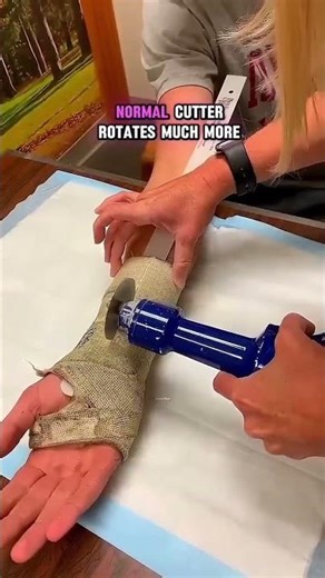 Why Doctors’ Plaster Cutters Are Safe for Skin 🩹✂️