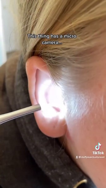 Smart earwax camera