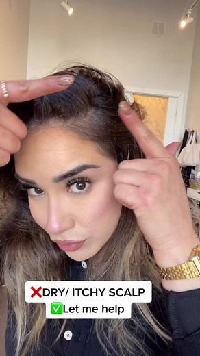 Effective Dry Scalp Care Tips for Healthy Hair