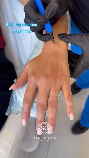 316K views · 387 reactions | Sculptra gradually helps restore your...