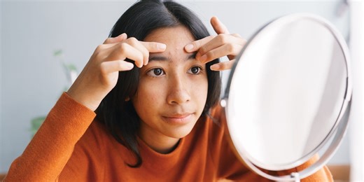 My teenager is really struggling with acne. How can I help?