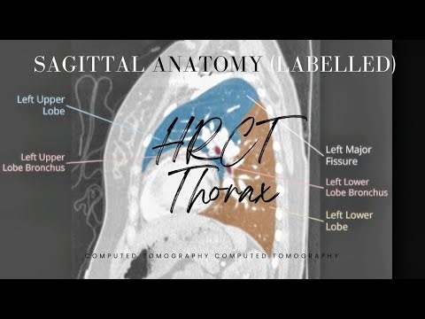 HRCT Thorax Sagittal Anatomy | Labelled CT Scan | Part 3