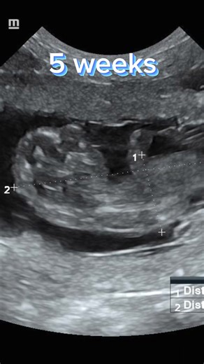 Dog PREGNANCY weekly ULTRASOUNDS: Part 1