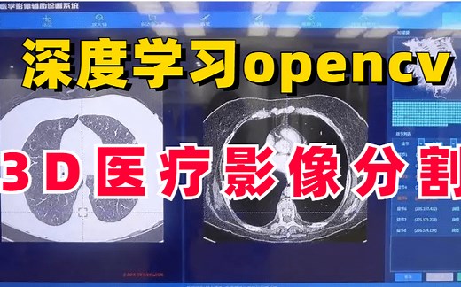 【深度学习opencv】计算机视觉-3D医疗影像分割，我居然3小时学懂了计算机视觉入门到实战，多亏了这个课程，看不懂你打我！！！cv视觉在医学领域的运用