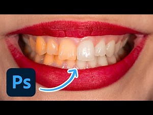 How To Whiten Teeth In Photoshop (Best Way!)
