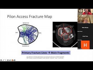 Principles of imaging in the pilon fracture