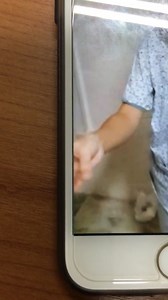 [medical student] สงสัยข้อนี้.....น้องท่านหนึ่ง inbox มาถาม ประกอบกับให้เหตุผลว่าทำไมสงสัยมาแล้ว วันนี้จึงขอมาเฉลย มีคลิป A 23-year-old lady presented with generalized tonic-clonic seizures. She had a history of febrile convulsion when she was a child. Her mother noticed in these 10 years she has had intermittent loss of awareness with abnormal hand movement lasting 13 minutes which episodes are triggered by sleep-deprivation. She sometimes feels that the environment surrounding her seems famili