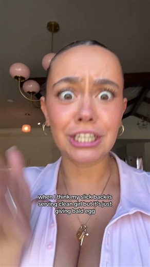 they call me egg head 🤓 #girls #shorts