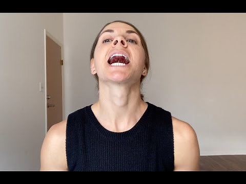Tongue Suction - Myofunctional Therapy Self-Assessment