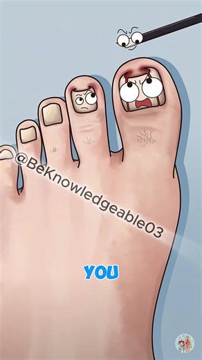 The Biggest Mistake You Make Cutting Your Nails! 😱🦶