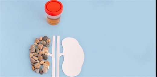 Our bodies don’t just make gall and kidney stones – from saliva to tonsils, these are other ones to look out for