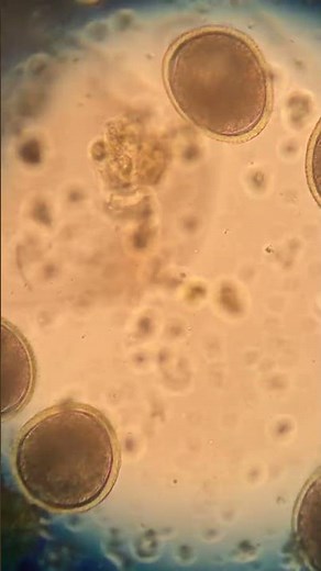 Huevo de Toxocara Canis