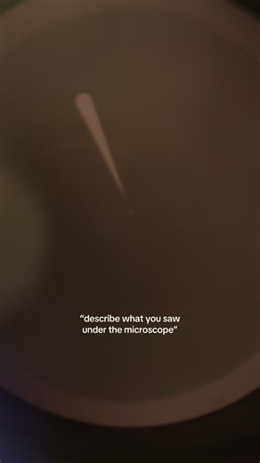 my spit sample🥰🥰🥰 | microscope