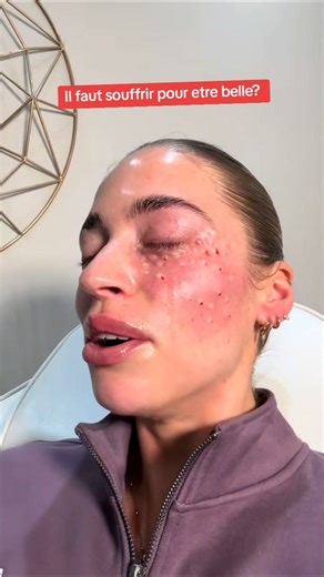 💉 Voici à quoi ressemble cette injection hyper douloureuse dont tout le monde parle…