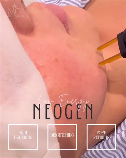 A Low Energy Neogen treatment is one of our favorite ways to get smoother, glowy and healthy looking skin without downtime. Neogen uses controlled nitrogen plasma to heat the skin to support natural renewal and give you a fresh, radiant appearance (perfect to do before your holiday get togethers!) Book a consult to see how Neogen can work for you. Link in bio! #medspa #yll #skincare #antiaging #confidence #skintreatments | Maple Grove Aesthetics
