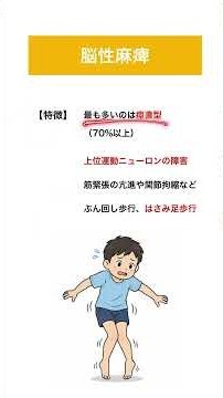 【1分でわかる】国試でよく出る脳性麻痺と特徴 # #国家試験#国家試験対策 #看護師 #鍼灸師