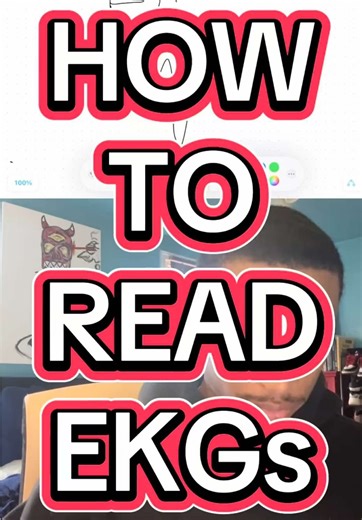 If you need help reading EKG’s you came to the right place #ekg #medical #science #fyp #study