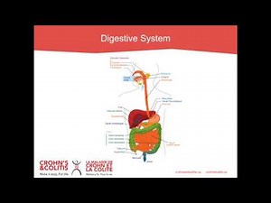 Ostomy 101 - Everything you Need to Know about Ostomies and Pelvic Pouches