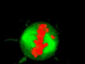 Mitosis in 3D - With Chromosome Bridge