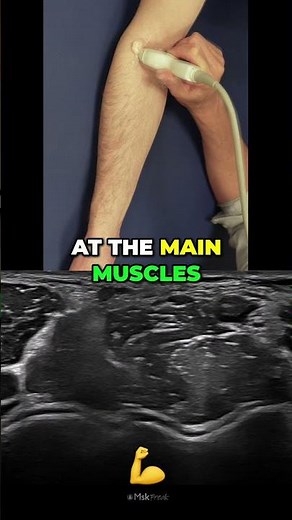 Elbow Muscles Brachialis Explained