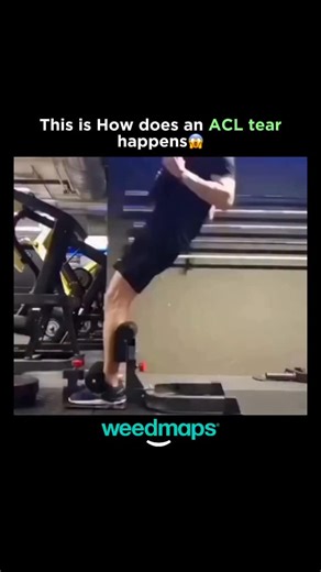 Bio Decoded | Science | Facts | An ACL injury is a tear or sprain of the anterior cruciate (KROO-she-ate) ligament (ACL) - one of the strong bands of tissue that help... | Instagram