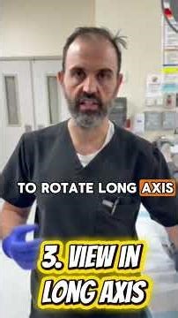 Ultrasound Guided Subclavian