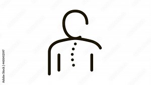 Curvature Spinal Column Orthopedic animated black icon on white background Stock Video