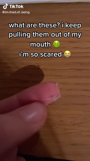 #ewww #help #pinworms | pinworms