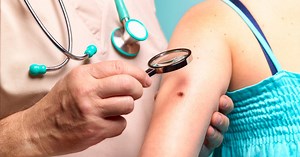 Five early skin cancer symptoms to look out for as cases reach record high