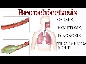 Bronchiectasis: Causes, Symptoms, and Diagnosis and More