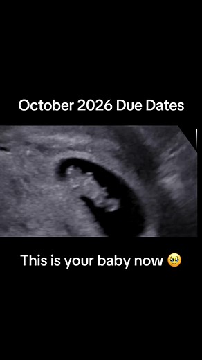 October 2026 Due Dates: Expecting Your Baby Soon!