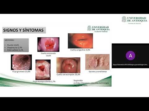 Risk Factors Associated with Vaginal Infections - Dr. Manuela Mesa