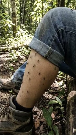 Mosquitoes all over leg 😓