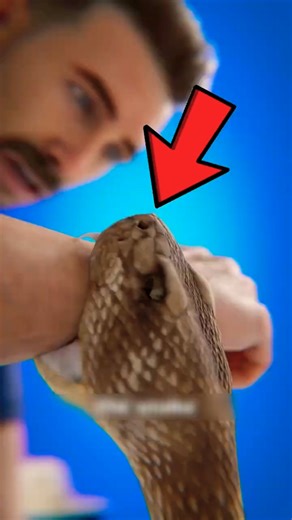 If a Snake Bites You and WON’T Let Go… Do THIS Before It’s Too Late!