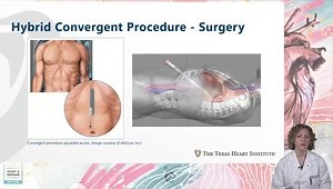 Atrial Fibrillation: New Treatments