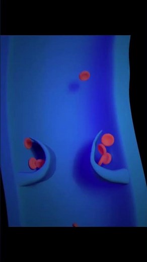 Vein treatments fix leaky veins, relieve swelling, & improve leg health!💉 #VeinTreatment #LegRelief