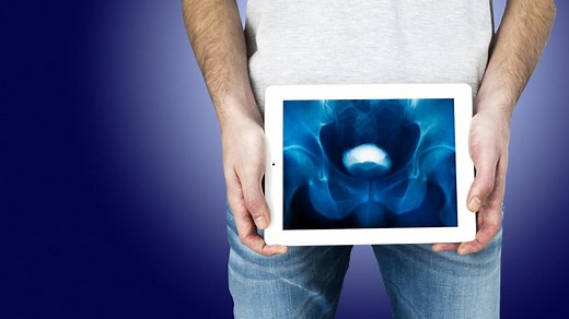 Die Gesundmacher : Unter der Gürtellinie – mit dem Urologen im OP