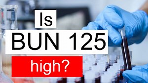 Is BUN 125 high, normal or dangerous? What does Blood urea nitrogen level 125 mean?
