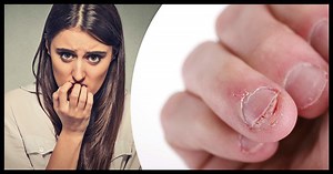 Nail-Biting Isn't Just a Bad Habit - It's a Health Hazard