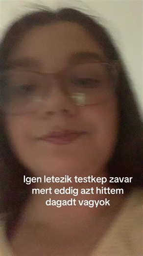 Negativ kommenteket mellozzetek nem dagadt vagyok csak a stresztol folyton hizokez ellen kuzdok🙏